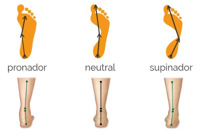 tipos de pisada analisis de pisada